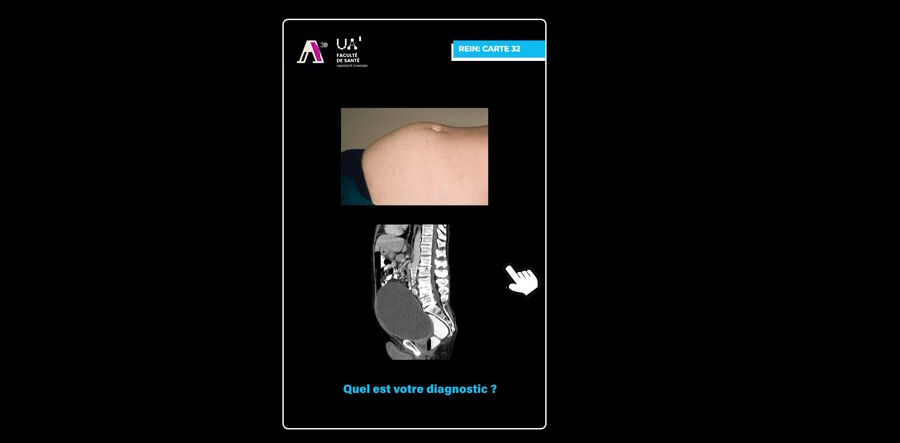 [Translate to chinese:] App for medical students developed by the University of Angers. Image courtesy of Dr. Florian Bernard.