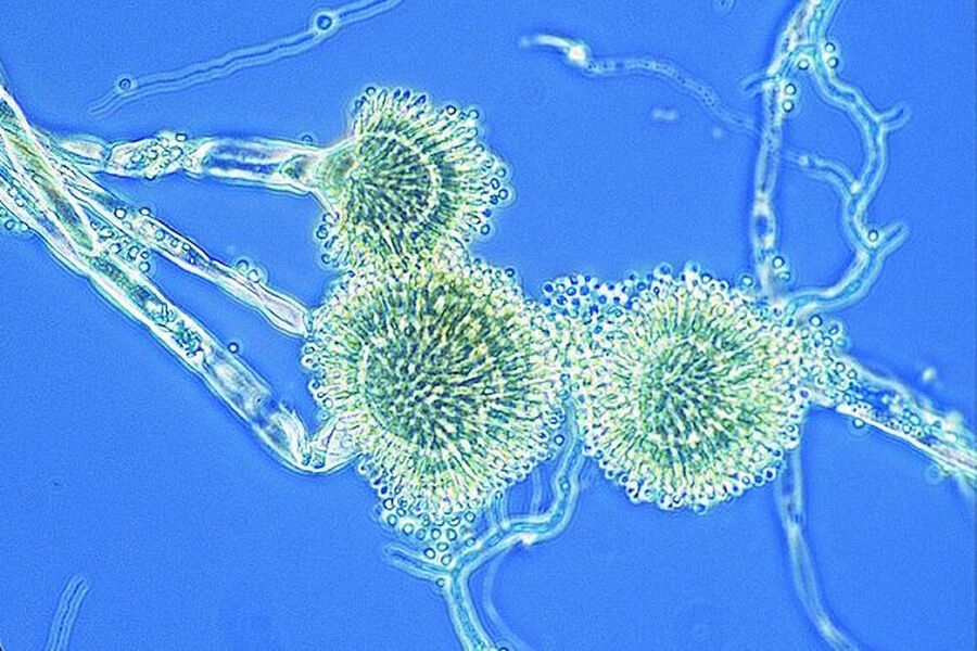 图5：曲霉菌的相差图像。