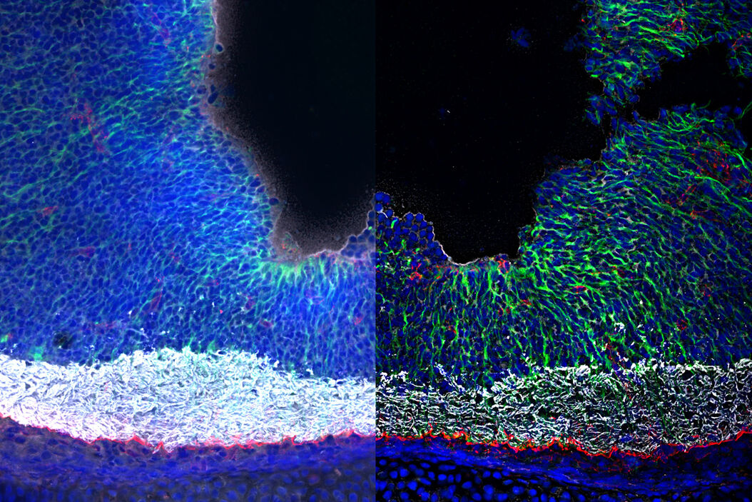 [Translate to chinese:] Mouse kidney section with Alexa Fluor™ 488 WGA, Alexa Fluor™ 568 Phalloidin, and DAPI. Sample is a FluoCells™ prepared slide #3 from Thermo Fisher Scientific, Waltham, MA, USA. Images courtesy of Dr. Reyna Martinez – De Luna, Upstate Medical University, Department of Ophthalmology. The_Power_of_Pairing_Adaptive_Deconvolution_teaser.jpg