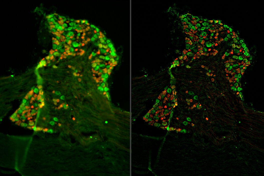 [Translate to chinese:] Raw widefield and THUNDER image of a mouse dorsal root ganglion with tdTomato (red) expressed in the sensory neurons. Mouse_dorsal_root_ganglion_sensory_neurons_THUNDER_teaser.jpg