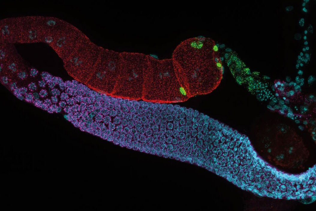 [Translate to chinese:] C. elegans adult hermaphrodite gonades acquired using THUNDER Imager. Staining: blue - DAPI (nucleus), green - SP56 (sperm), red - RME-2 (oocyte), magenta - PGL-1 (RNA + protein granules). Image courtesy of Prof. Dr. Christian Eckmann, Martin Luther University, Halle, Germany. C_elegans_adult_hermaphrodite_gonades.jpg