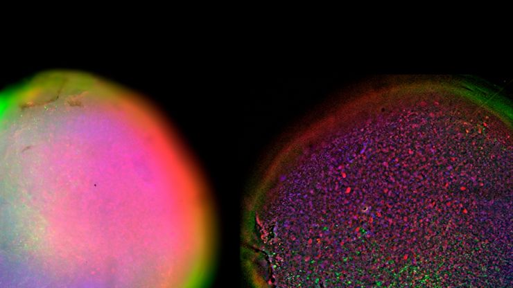 Large field of view (FOV) 2D slices of a 1 mm diameter midbrain neural organoid stained with DAPI (blue, nuclear stain), β-tubulin (green, neuronal stain), and GFAP (red, astrocyte stain). Acquired on THUNDER Imager Cell with 10x magnification. Left: Raw widefield image, Right: THUNDER cleared image. Scale bar 400 μm. Sample courtesy of Dr Tanya Singh, University of Oxford, UK.