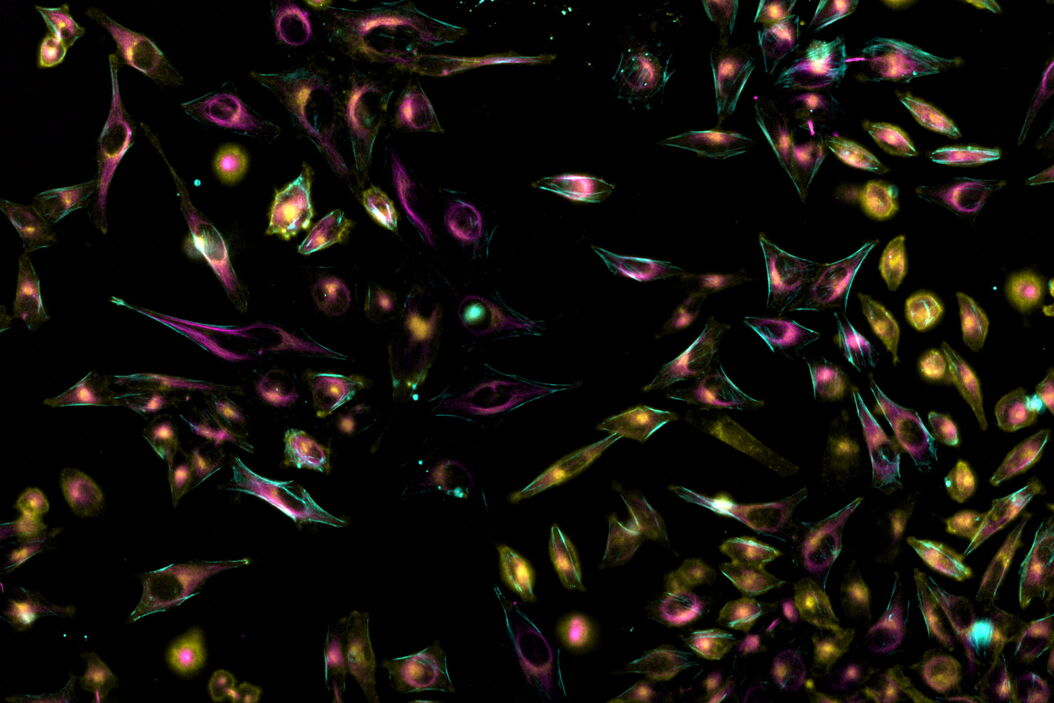 [Translate to chinese:] Living HeLa cells stained with WGA-488 (yellow), SPY-Actin (cyan), and SiR-Tubulin (magenta). Instant Computational Clearing (ICC) was applied. Living_HeLa_cells_Instant_Computational_Clearing.jpg