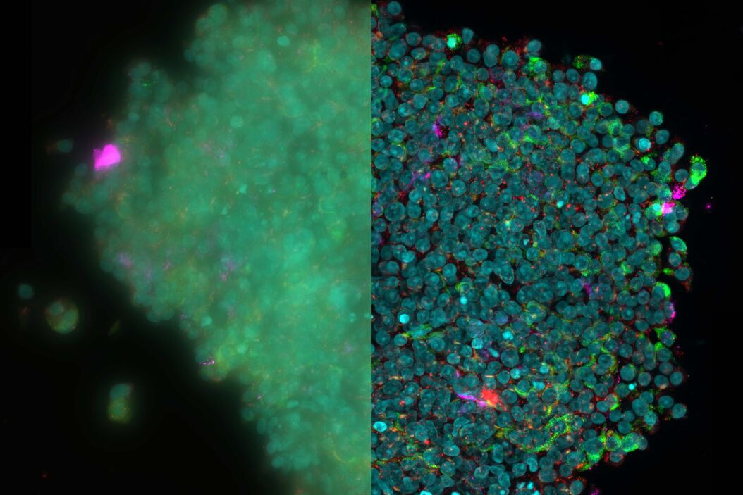[Translate to chinese:] 3D reconstruction of an isolated human islet THUNDER-Imager-3D-Cell-Culture_isolated-human-islet.jpg