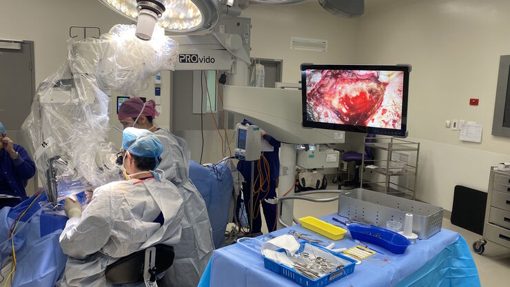 According to Dr. Flanagan, the PROvido IVA surgical microscope provides optimal visualization, supporting the needs of tympanoplasty surgery. Image courtesy of Dr. Sean Flanagan.