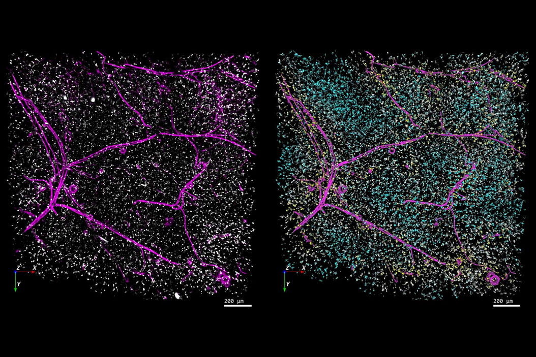 [Translate to chinese:] Left-hand image: The distribution of immune cells (white) and blood vessels (pink) in white adipose tissue (image captured using the THUNDER Imager 3D Cell Culture). Right-hand image: The same image after automated analysis using Aivia, with each immune cell color-coded based on its distance to the nearest blood vessel. Image courtesy of Dr. Selina Keppler, Munich, Germany. Fat_tissue_THUNDER_THUNDER-Aivia_teaser.jpg