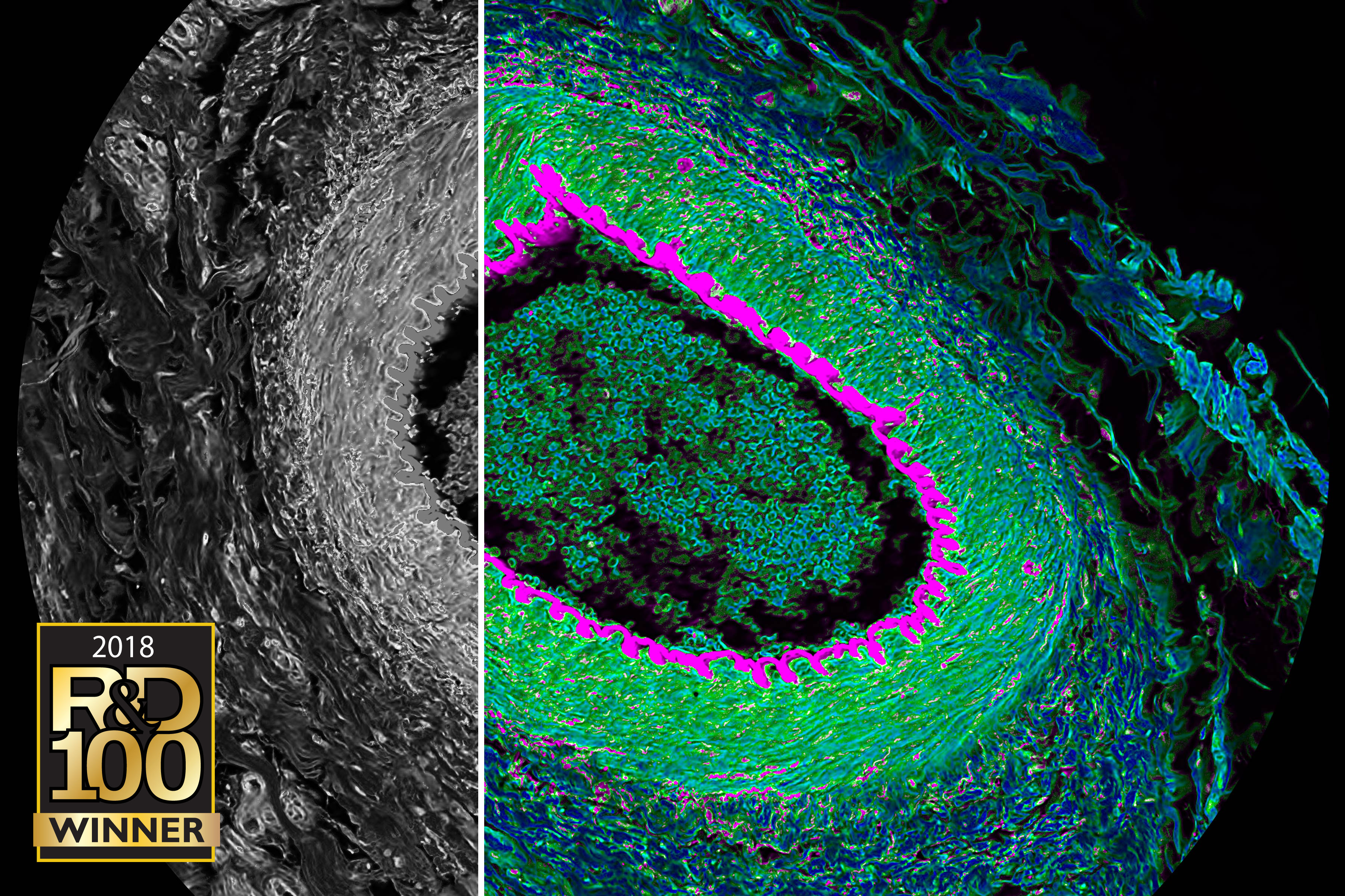 Histological section from cat eye. Simultaneous spectral (grey) and FLIM (color) confocal imaging reveals contrast by lifetime. Acquisition and visualization using SP8 FALCON and LAS X software. Histological section from cat eye. Simultaneous spectral (grey) and FLIM (color) confocal imaging reveals contrast by lifetime. Acquisition and visualization using SP8 FALCON and LAS X software.