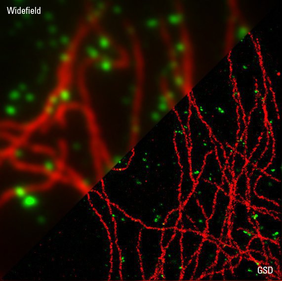  Clathrin_Microtubuli_GSD_05.jpg