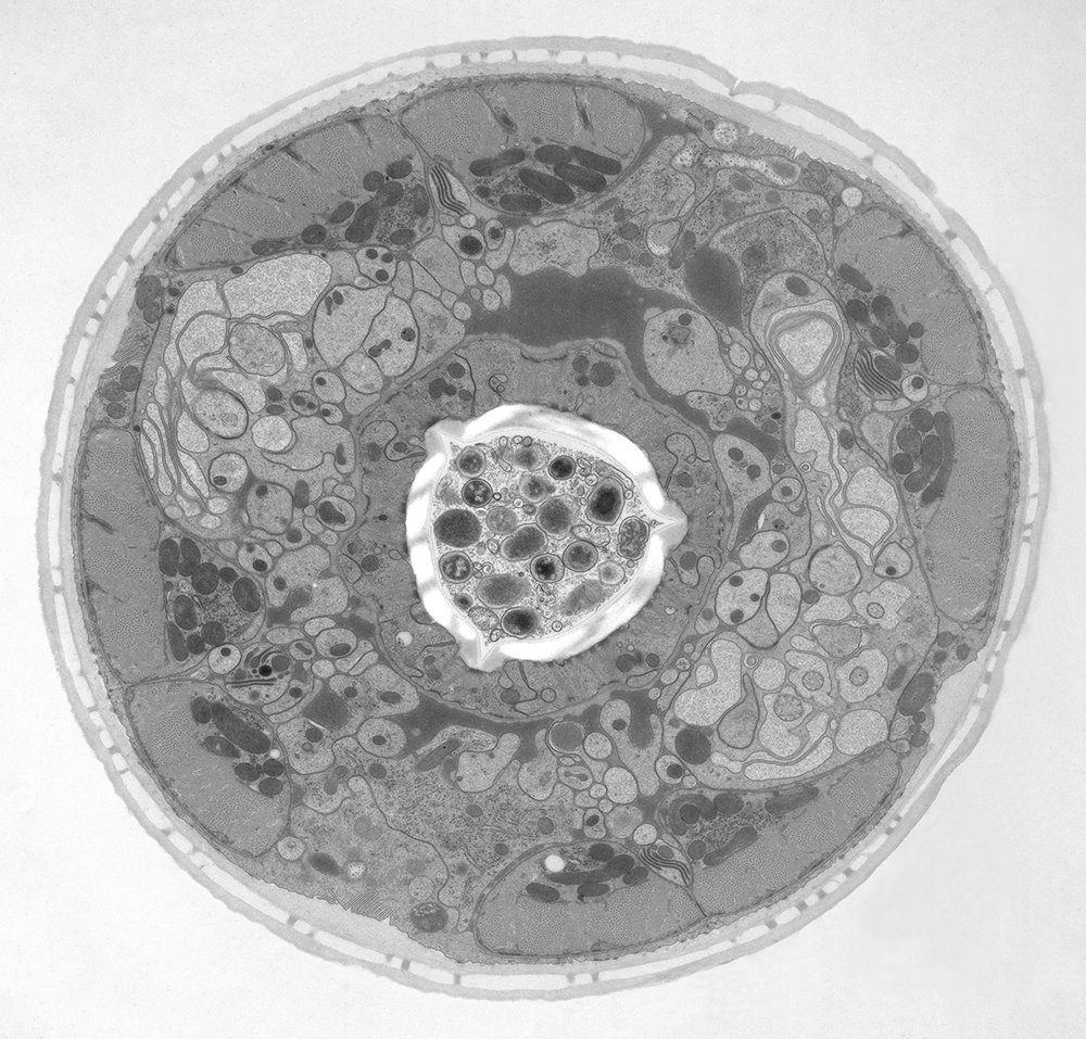 Electron microscope (EM) image of a cross section of C. elegans (roundworm). Courtesy of T. Müller-Reichert, MPI-CBG, Dresden, Germany and K. McDonald, University of California, Berkeley, USA.
