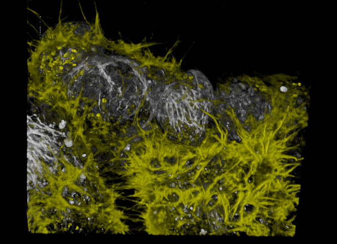 Traditional Confocal