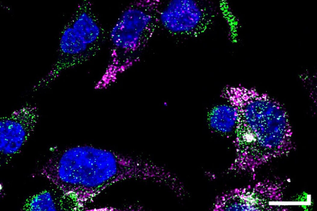 GLP-1 and PYY localized to distinct secretory pools in L-cells. GLP-1 and PYY localized to distinct secretory pools in L-cells. L-cells.jpg