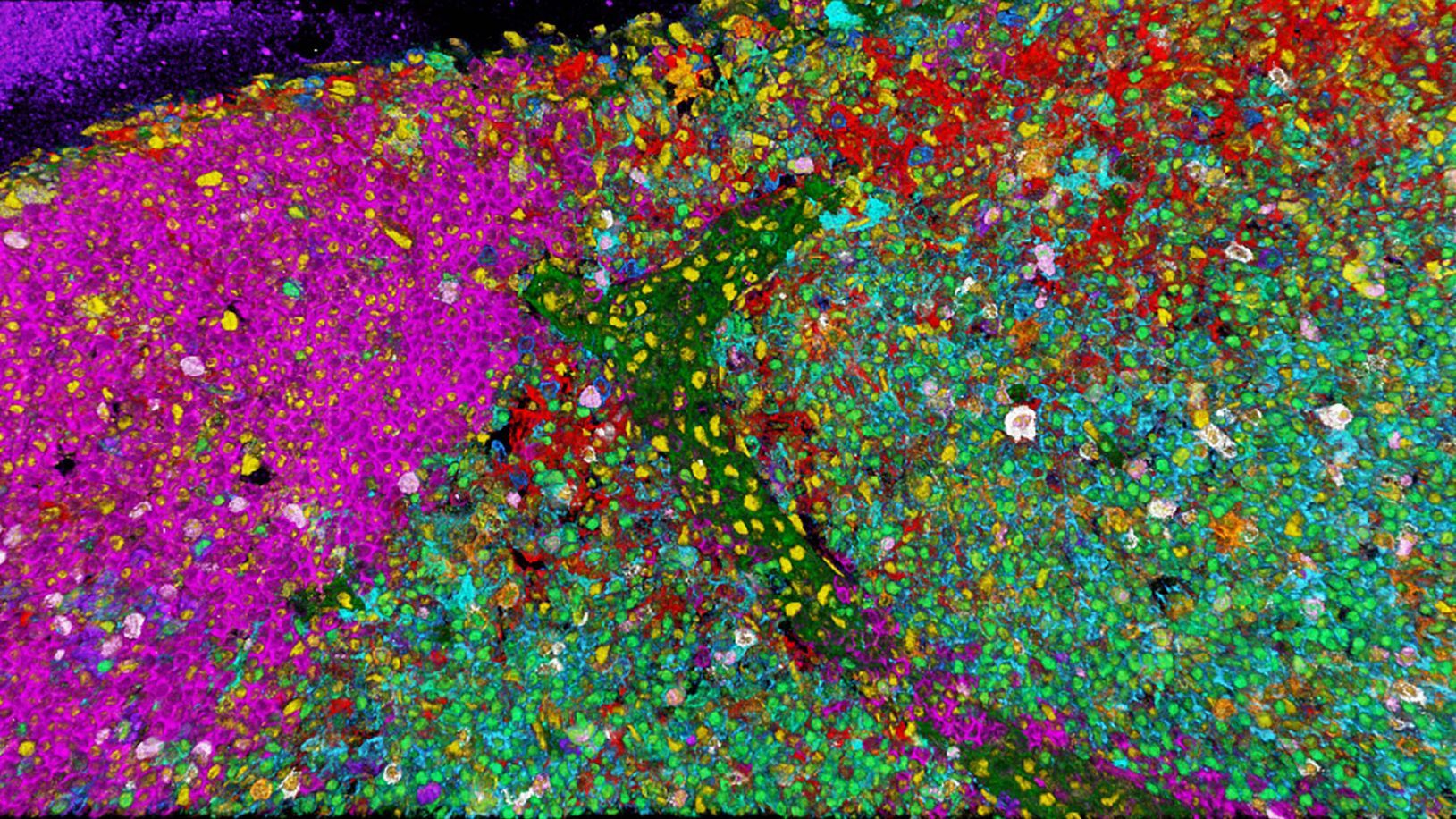 3D 15-plex imaging for phenotyping in immune response. Image acquired using STELLARIS with SpectraPlex. Roberti J., Hecht F., Gai E., Straka T., Holzmeister S., Steinmetz I., Wong H., Alvarez L. Nat. Methods (2024). 