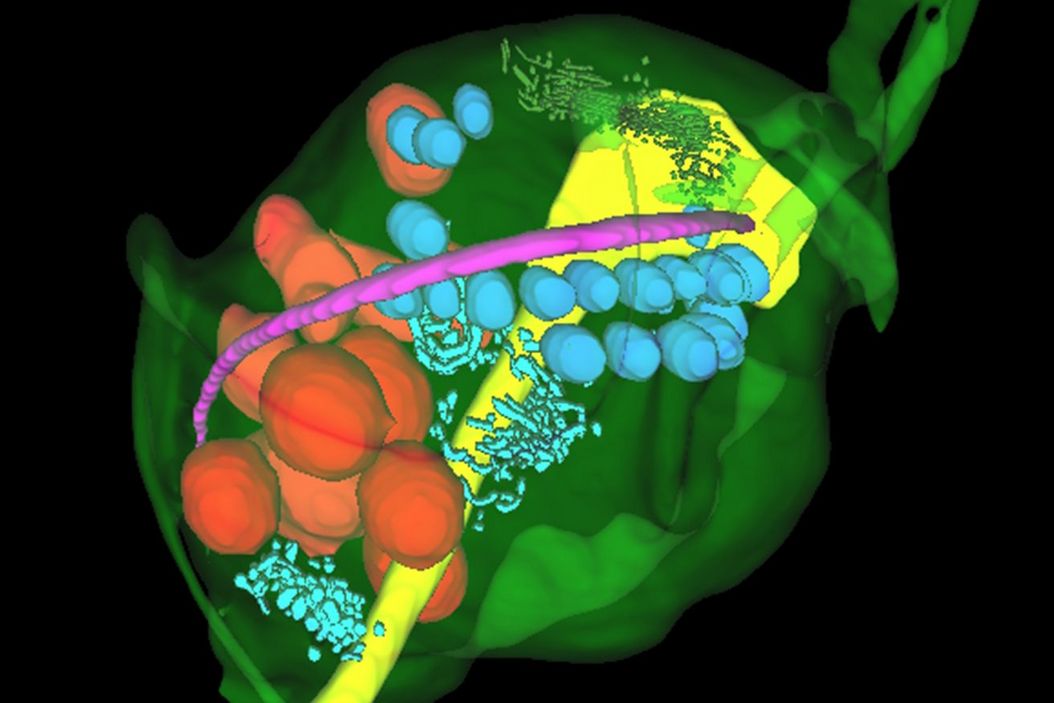 Final Segmentation of organelles in Trichomonas species. Magenta – costa, light blue – hydrogenosomes, turquoise – ER, red – vacuoles, yellow – axostyle, green – Golgi apparatus.  Sample courtesy of Isabelle Guerin-Bonne, Low Kay En, Electron Microscopy Unit, Yong Loo Lin School of Medicine, National University of Singapore. Scale bar: 1 µm. Final_Segmentation_of_organelles_in_Trichomonas_species.jpg