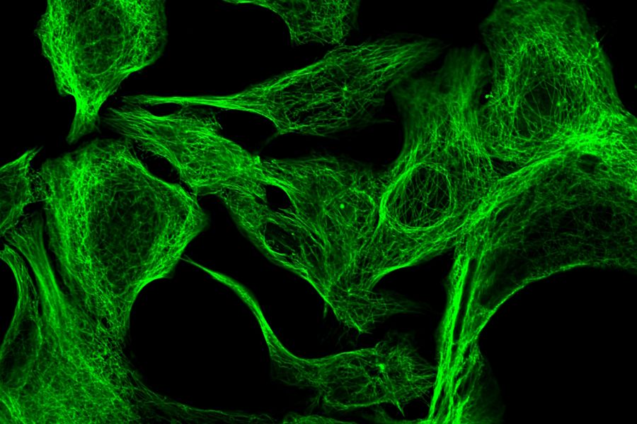 甲醇固定 MDA-MB-468 细胞，用小鼠 IgG 抗 beta-微管蛋白（一级）和用 ATTO 488 标记的驴 IgG-fab2-片段抗小鼠（二级）微管蛋白抗体染色。