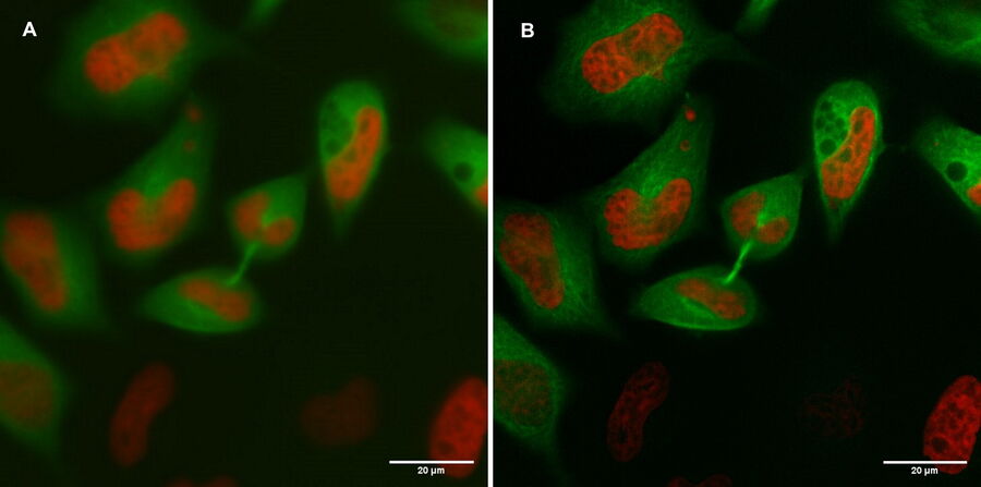 A) 感兴趣细胞的标准 WF 图像，使用绿色和红色荧光通道成像。B) 使用THUNDER小体积计算技术对数据进行后处理。