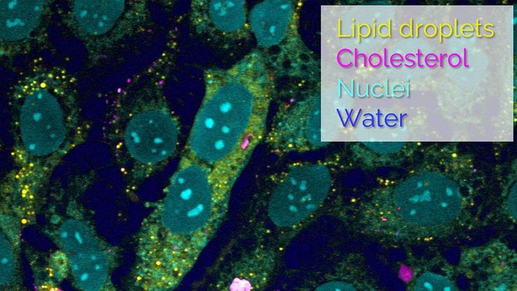 SRS光谱扫描解混结果