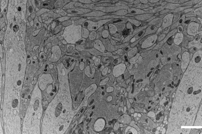  Workflows_and_instrumentation_for_cryo-electron_microscopy_teaser.jpg