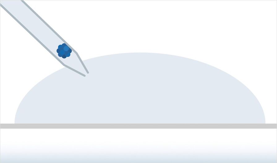 Spheroid transferred into a hydrogel drop