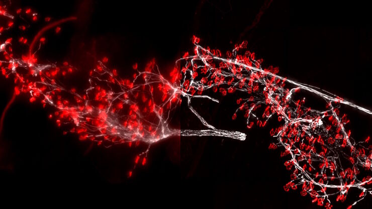 [Translate to chinese:] Raw widefield (left) and Computationally Cleared image (right) of mouse neuromuscular junctions acquired with a THUNDER Imager. Courtesy of A. Yung and M. Krasnow in California, USA.