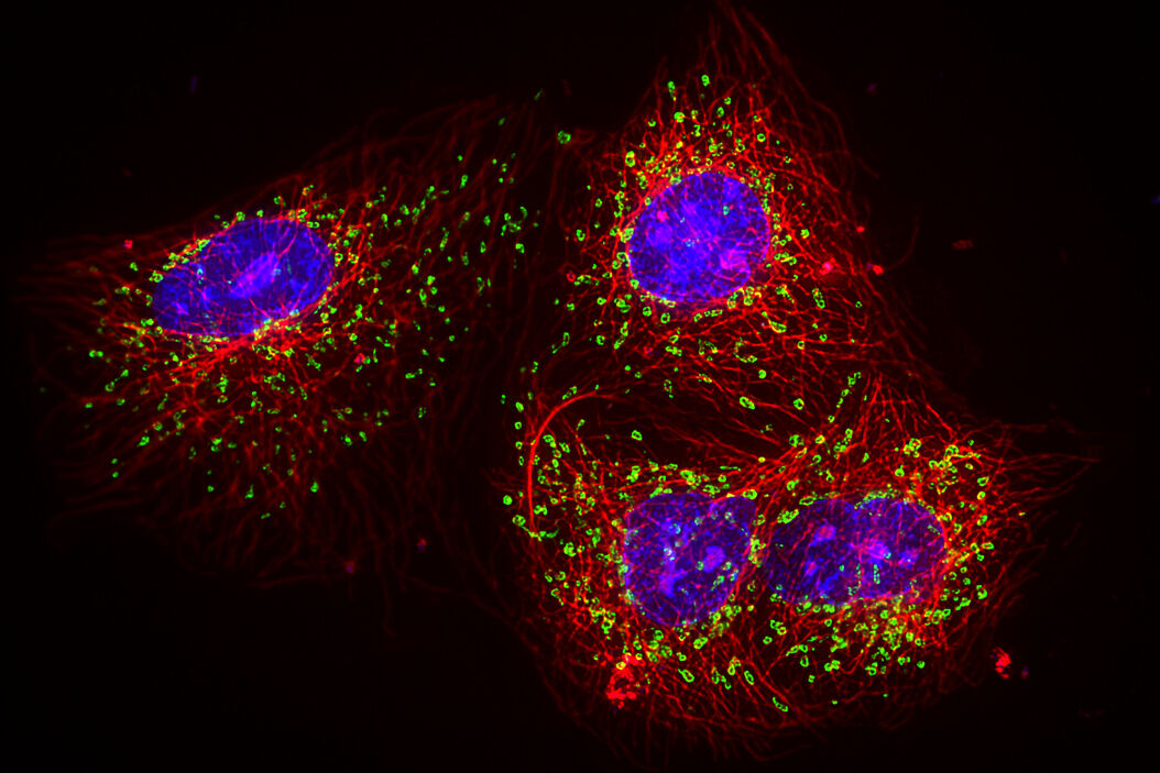 [Translate to chinese:]  Unmixing_multicolour_widefield_fluorescence_images_teaser.jpg