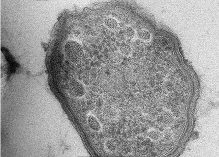 图6：酸硫杆状菌 HV2/2。感谢马堡大学Dr. Andreas Klingl提供的图片。