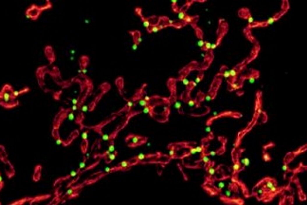 [Translate to chinese:] Dual color volume rendering of Drp1 oligomers (green) and mito OM (red) in a live U2OS cell Dual_color_volume_rendering_in_a_live_U2OS_cell.jpg