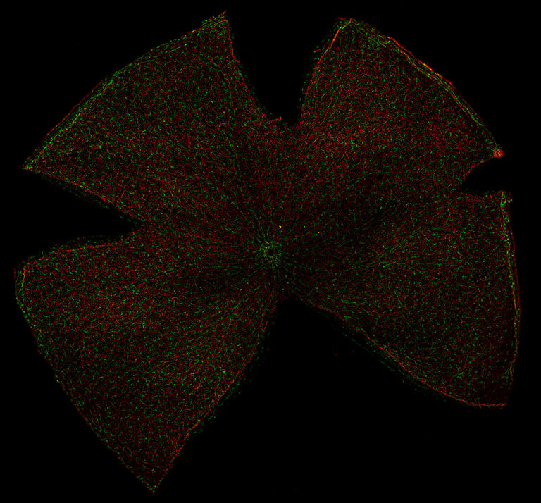 对照组瑞士成年小鼠全组织视网膜，显示 Iba1 + 小胶质细胞（Alexa Fluor® 488 绿色荧光染色）和 Brn3a + 视网膜神经节细胞（Alexa Fluor® 594 红色荧光染色）。图片由西班牙 Murcia 大学的实验眼科学小组提供。