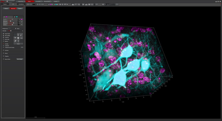 [Translate to chinese:] 3D Reconstruction of brain slide image_Mica