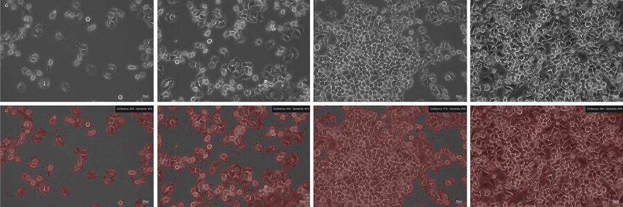 [Translate to chinese:] Example of a confluency check for HeLa cells: The top row shows phase-contrast images and the bottom row determination of cell confluency. The Mateo TL algorithm measures the percentage of the area covered by the cells.