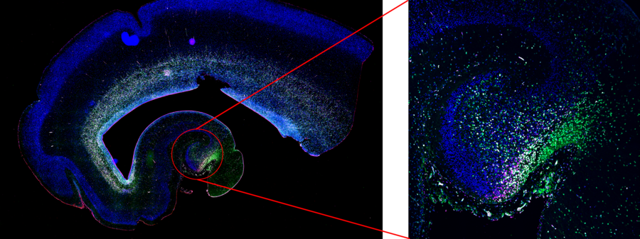 Several neural stem cells (green) can be found in a proliferative state, marked by Ki67 (gray) and/or MCM2 (magenta). 在多个神经干细胞(绿色)中可观察到Ki67(灰色)和/或MCM2(品红色)标记的增殖状态。左侧:使用Mica搭配PL APO 20x/0.75 CS2物镜在宽视场模式下迅速获取马赛克图像,300张原始图像在几秒钟内完成拍摄。右侧:未移动样本的情况下,使用共聚焦模式高分辨率拍摄同一样本的海马齿状回。图片由英国伦敦弗朗西斯·克里克研究所的博士生Piero Rigo提供。