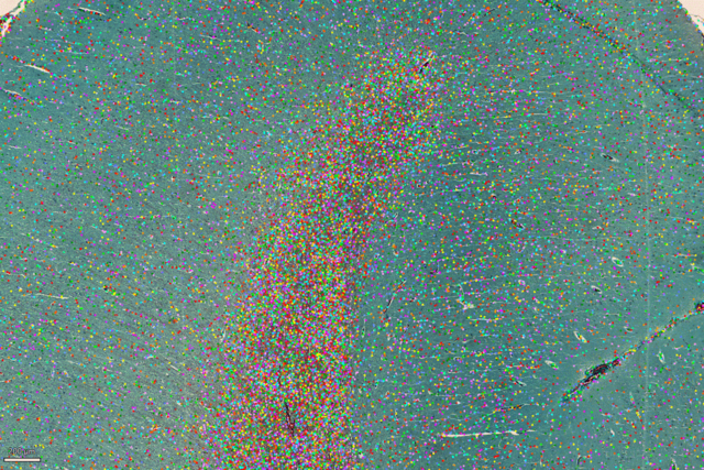 使用 LAS X Navitator查看 H&E 染色的组织拼图