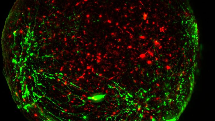 [Translate to chinese:] Virally labeled neurons (red) and astrocytes (green) in a cortical spheroid derived from human induced pluripotent stem cells. THUNDER Model Organism Imager with a 2x 0.15 NA objective at 3.4x zoom was used to produce this 425 µm Z-stack (26 positions), which is presented here as an Extended Depth of Field (EDoF) projection.  Images courtesy of Dr. Fikri Birey  from the Dr. Sergiu Pasca laboratory at Stanford University, 3165 Porter Dr., Palo Alto, CA