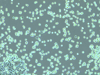 Detached cells should be round and free floating in the trypsin solution.