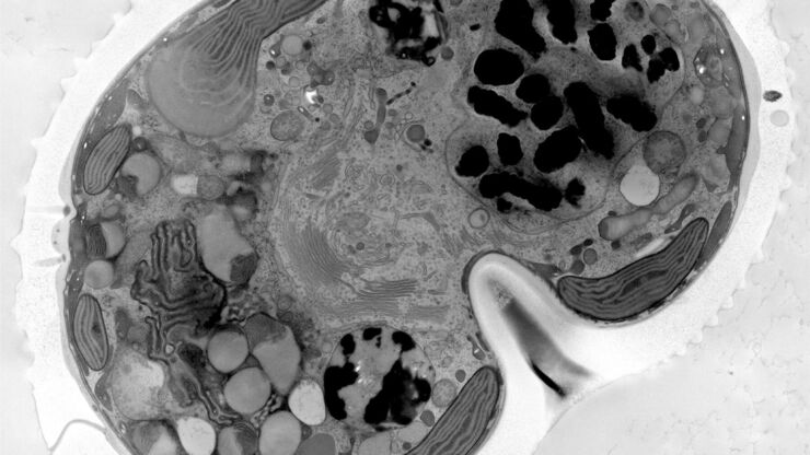 Micrograph of dinoflagellate cells. Scale bar = 1 µm.   