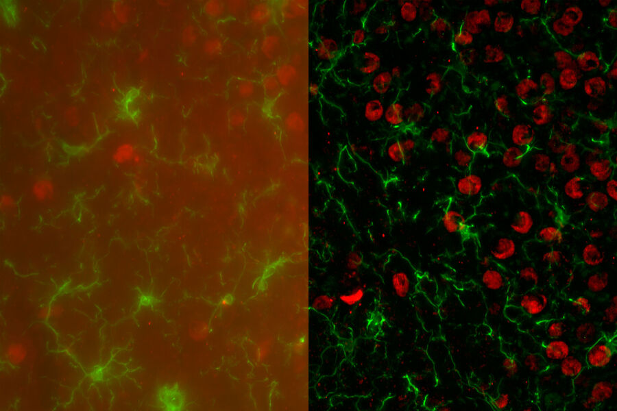 Mouse brain captured on a THUNDER Imager 3D Cell Culture 这些图像显示了小鼠大脑中小胶质细胞(IBA-1+,绿色)表达的AMPK(红色)。图像是在THUNDER Imager 3D细胞培养上,使用40x/1.30油物镜拍摄的。两幅图像分别代表了28层平面(总共27微米厚度)的z堆栈的最大强度投影。左侧图像是原始的荧光显微图像,右侧图像是经THUNDER处理的LVCC算法图像。图像由德克萨斯农工大学的Maheedhar Kodali博士提供。