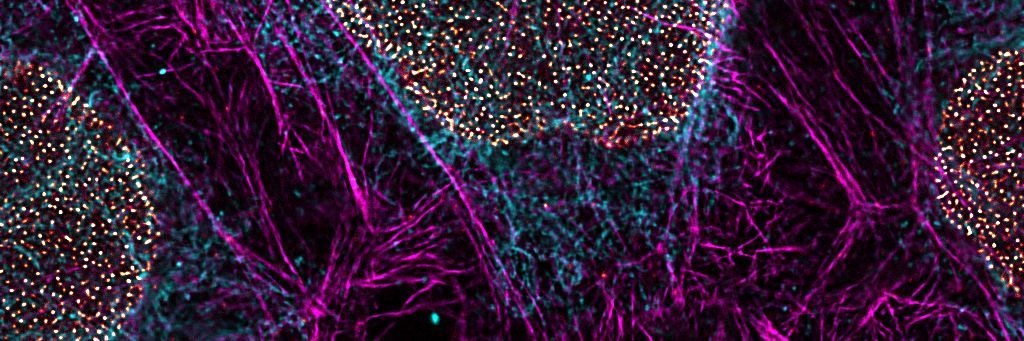 使用 STELLARIS STED 显微镜和 TauSTED Xtend 绘制的细胞内结构超分辨率图像。洋红色显示的是用 ATTO 647N 染色的肌动蛋白丝。