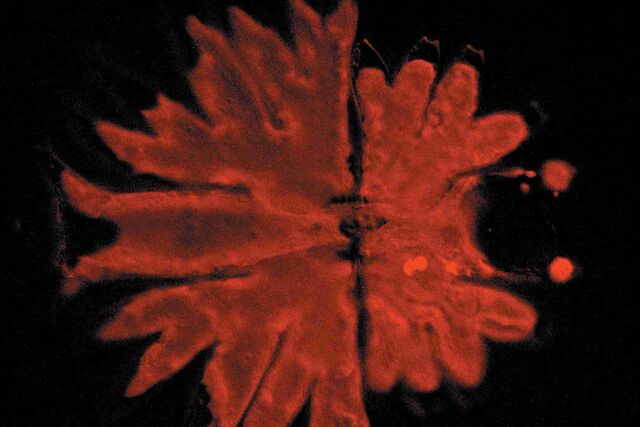 Micrasterias, fluorescence method Micrasterias, fluorescence method