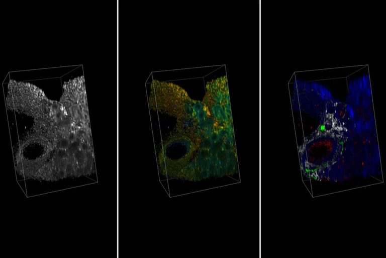 使用 RapidClear 透明化处理的肾脏切片并使用多光子激发成像。第一个图像是强度图像，第二个是 TauContrast（850 nm 激发），第三个来自四个光谱通道，其中红色表示血管（AF488，920 nm 激发）、灰色表示胶原蛋白 (SHG)、绿色表示神经细胞（SytoxOrange，1040 nm 激发）和蓝色表示色核（AF633，1100 nm 激发）。由 SunJin 实验室提供。