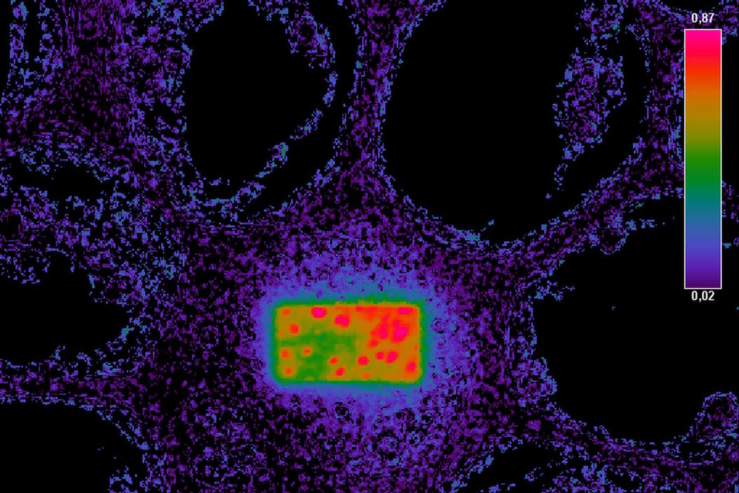  FRET_Acceptor_Photobleaching_false-color_image_according_to_the_formula_for_FRET_efficiency.jpg