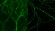 [Translate to chinese:] Mouse cortical neurons. Transgenic GFP (green). Image courtesy of Prof. Hui Guo, School of Life Sciences, Central South University, China 