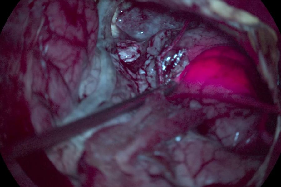 GLOW400 AR 解剖视图。图片由法国里昂临终关怀医院医学博士 Tim Jacquesson 提供。