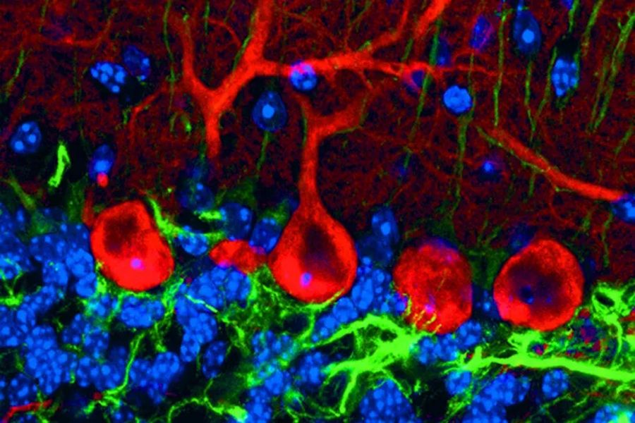 小鼠小脑皮层三重标记矢状切片中的浦肯野细胞或神经元。图像中，红色表示钙宾蛋白-D28k 钙结合蛋白（抗钙宾蛋白-D28k/Cy3），绿色表示神经胶质纤维酸性蛋白（GFAP）[抗 GFAP/Cy5]，蓝色表示细胞核（Hoechst 33258）。