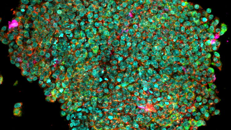 [Translate to chinese:] Extended depth of field reconstruction image of a whole human pancreas islet showing fluorescence signals from insulin (green), glucagon (red), an IL17 cytokine (magenta), and nuclei (blue).