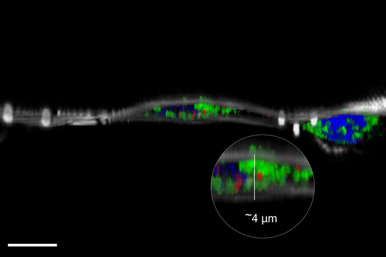 HeLa细胞显示Hoechst（蓝色，细胞核），Mitotracker Green（绿色，线粒体）、Bodipy（红色，脂滴）、荧光珠（品红色，1微米），反射（白色）。比例尺10微米：细胞由德国海德堡欧洲分子生物学实验室Mahamid团队的Ievgeniia Zagoriy提供