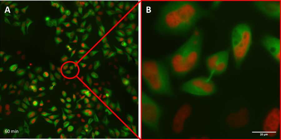 表达 H2B-mCherry 的 HeLa Kyoto HKF1 细胞（细胞核为红色）和表达 alpha tubuline-mGFP 的 HeLa Kyoto HKF1 细胞（细胞质为绿色）