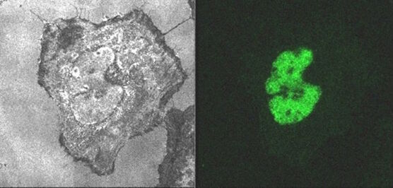 [Translate to chinese:] Hybrid detectors (HyDs) offer the use of gated detection, i.e. very fast switching of signal collection. In combination with a pulsed laser, particularly with the Leica white light laser (WLL) that is implemented in the Leica TCS SP8 X true confocal scann