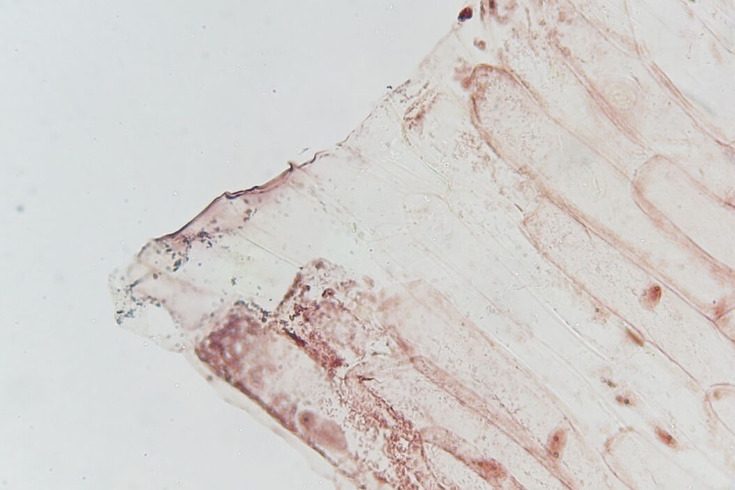 [Translate to chinese:] Image of an onion flake taken with a basic Leica compound microscope after it was tested for resistance to fungus and mold growth following part 11 of the ISO 9022 standard. Image_of_an_onion_flake_acquired_after_ISO_9022-11_test.jpg