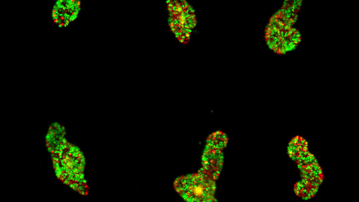 Intestinal organoids label with FUCCI reporter to follow cell cycle dynamics. Courtesy of Franziska Moos. Liberali lab. FMI Basel (Switzerland). Intestinal organoids label with FUCCI reporter to follow cell cycle dynamics. Courtesy of Franziska Moos. Liberali lab. FMI Basel (Switzerland).