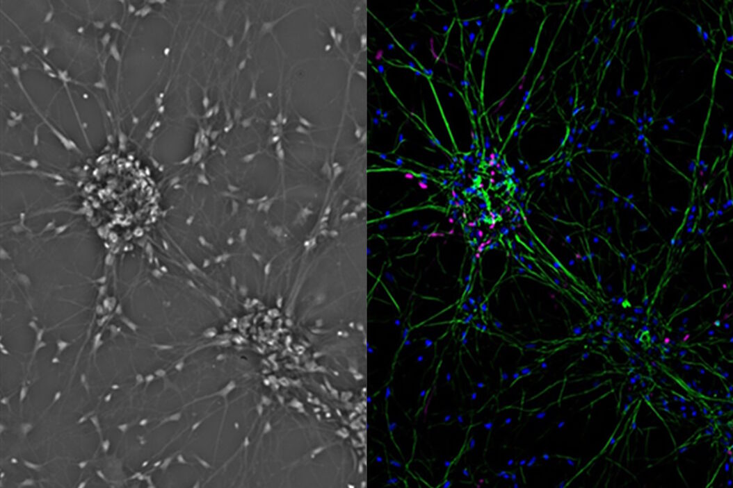 Mammalian cell culure. Phase contrast and fluorescence image. Mammalian_cells_culture_teaser.jpg
