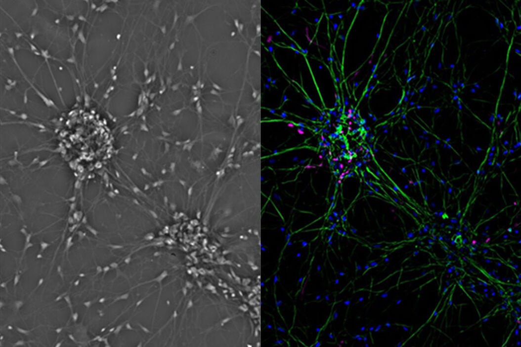 Mammalian cell culure. Phase contrast and fluorescence image. Mammalian_cells_culture_teaser.jpg